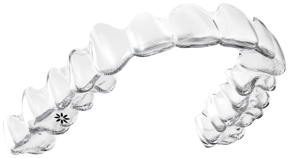 So sieht Invisalign aus: dünn, transparent, kaum sichtbar